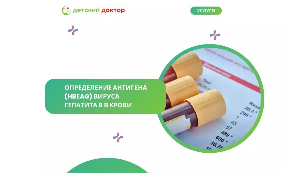 Определение антигена (HBеAg) вируса гепатита В в крови